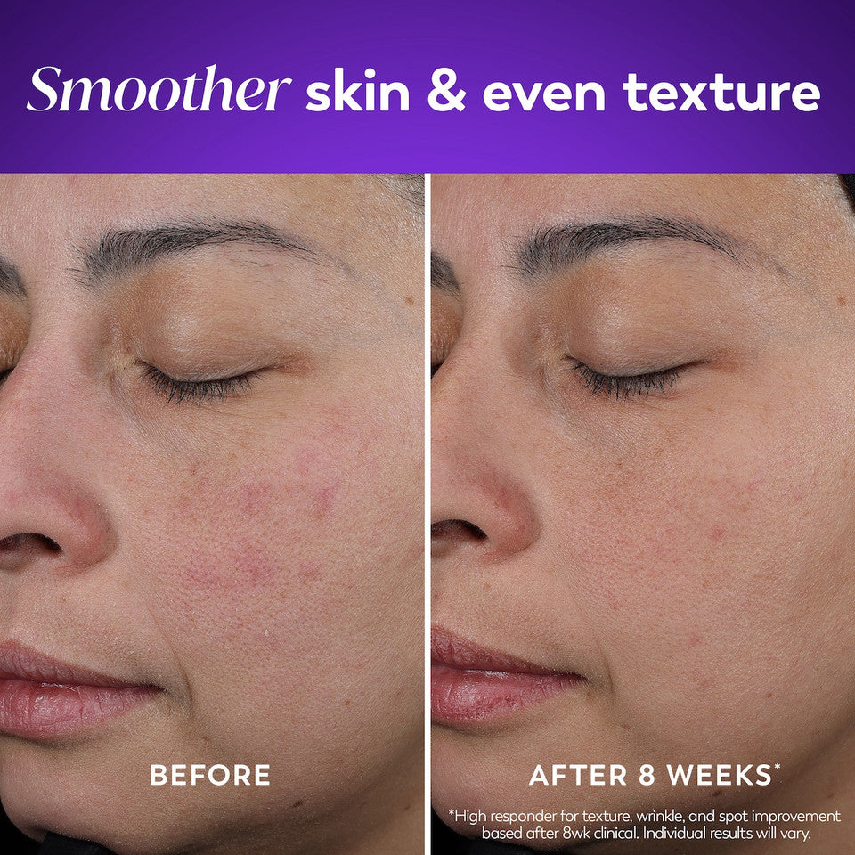 Olay Retinol24 Night Moisturizer - Image 7