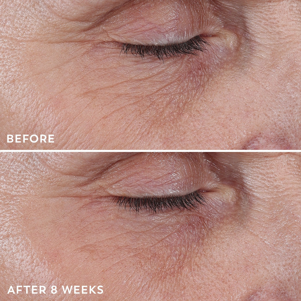 Regenerist Eye Wrinkle Correcting Treatment - Image 5