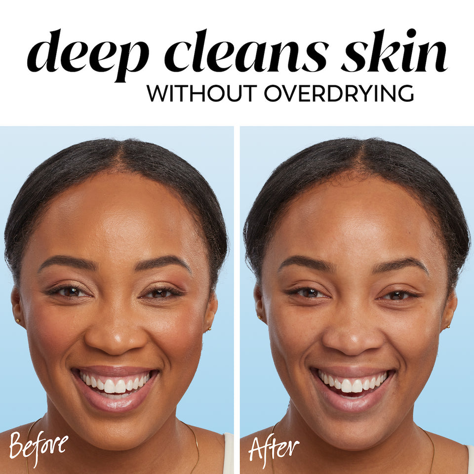 Olay Gentle Cleansing Melts - Image 7