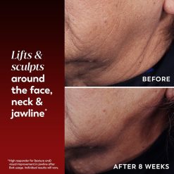Alternative view of Regenerist Face & Neck Lifting Treatment